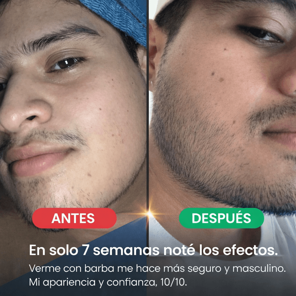 BÁLSAMO PARA CRECIMIENTO DE BARBA ULTRA POTENTE CON MINOXIDIL 20% | 100ML