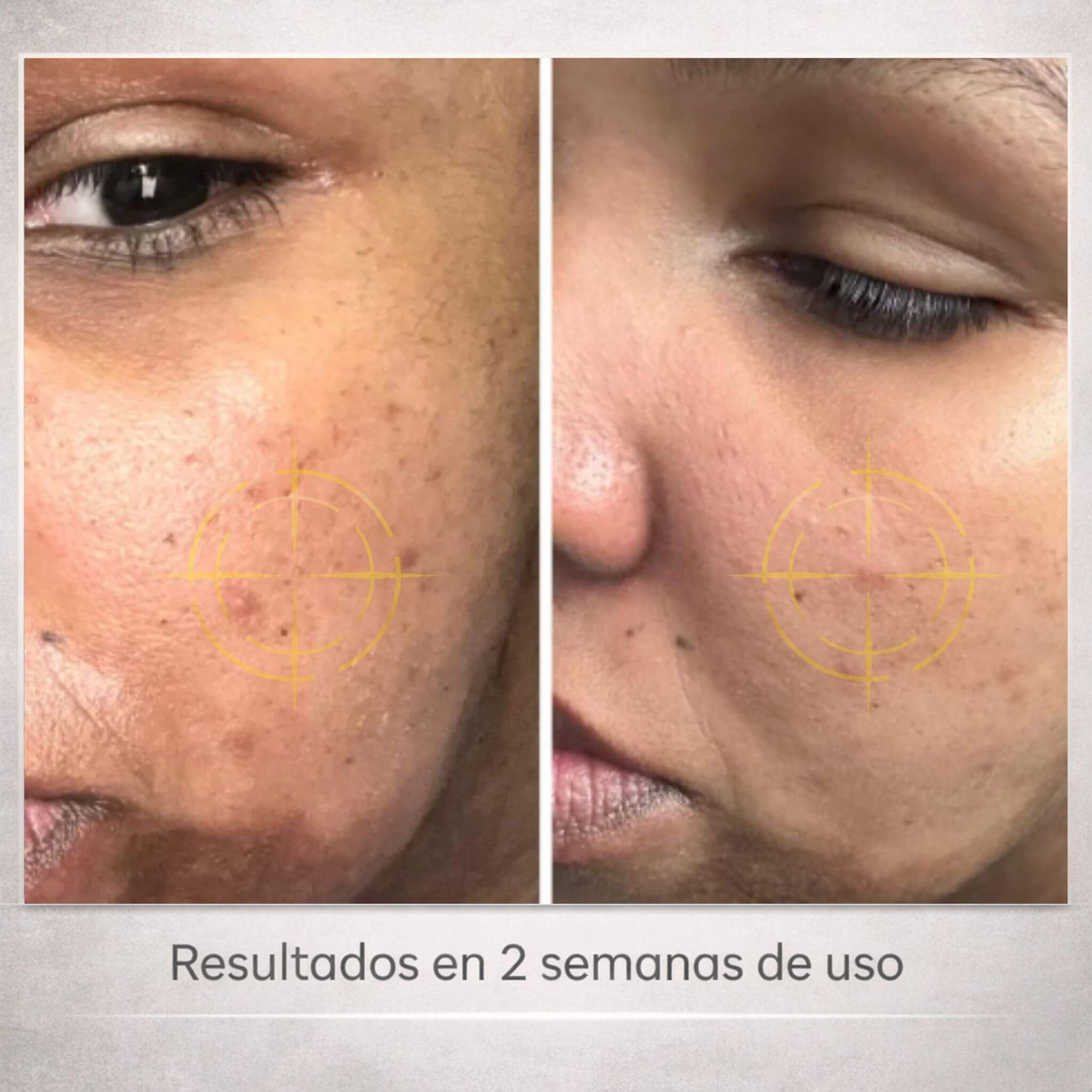 SERUM ANUA 30ML + NIACINAMIDA 10% + TXA 4%