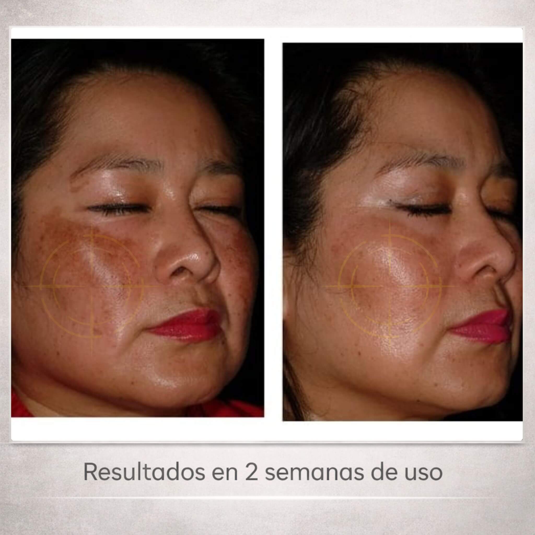 SERUM ANUA 30ML + NIACINAMIDA 10% + TXA 4%